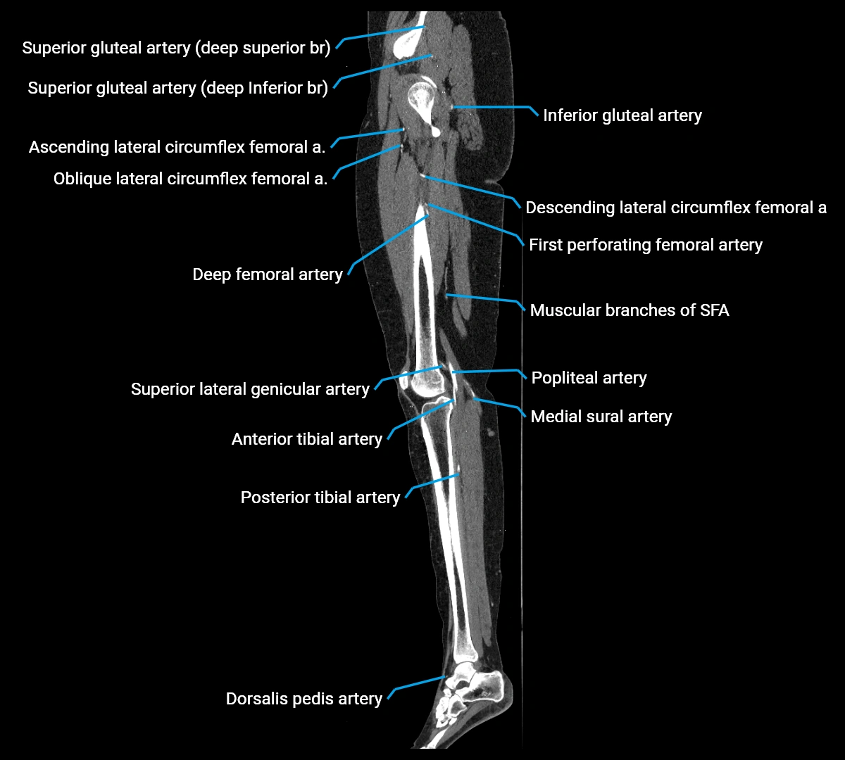 CTA lower limb sagittal cross sectional anatomy labelled image _45 (3).webp